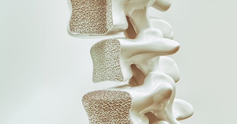 Bone mineral density