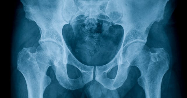 Röntgen bäcken