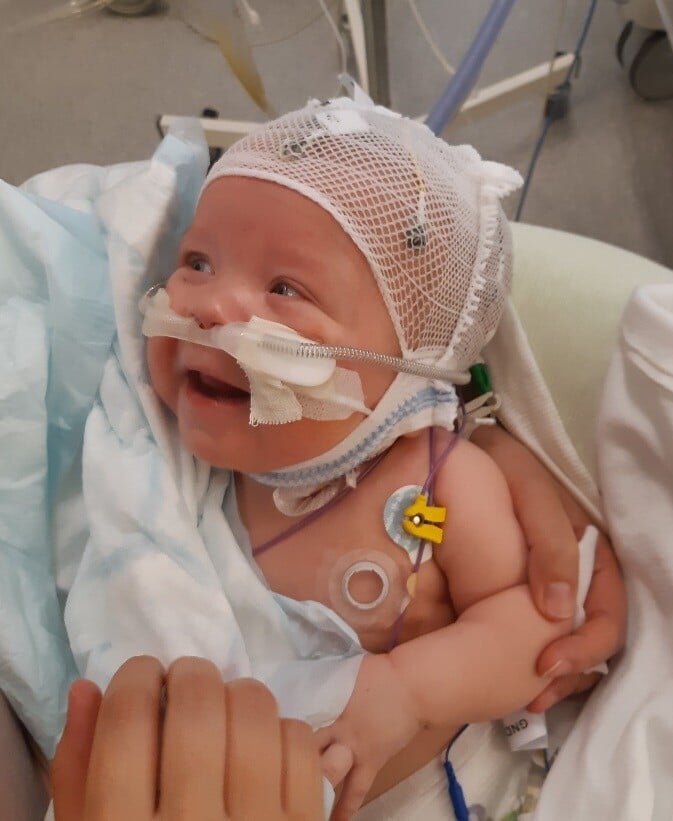 Premature baby