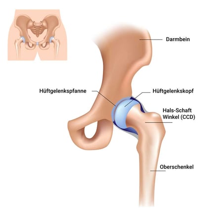 DE_Hip joint