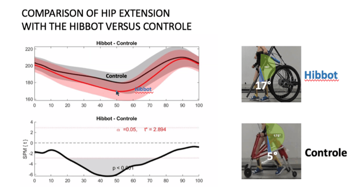 Comparison of hip extention-Hibbot-Versus-Controle