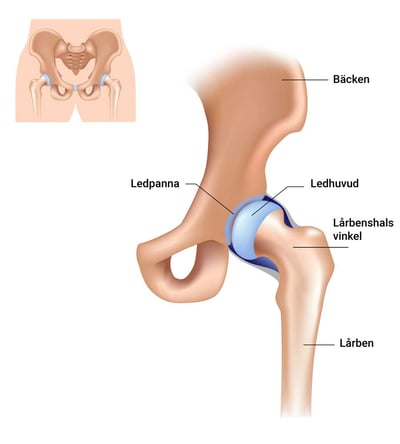 SE_Hip joint-1